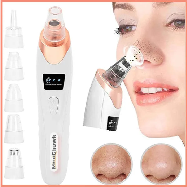 5-in-1 Blackhead remover  for deep  cleansing